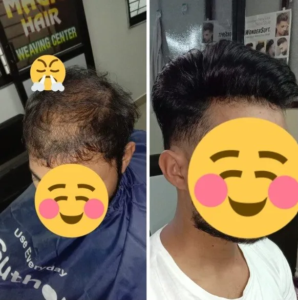 Hair Weaving Center in Nagpur: Revive Your Confide...