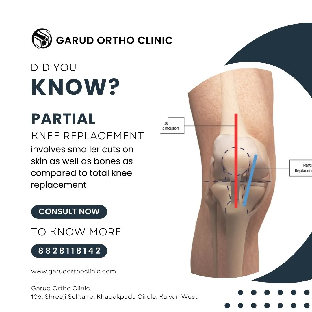 # Best Orthopedic Surgeon in Kalyan West
# Top Or...