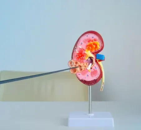 Best Kidney Stone Surgeon in Thane Dr. Vivek Jadha...