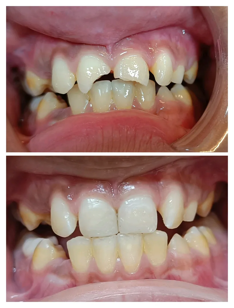 Case Presentation
Patient Details:
A young male p...