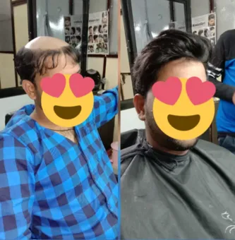 Hair Patch Center in Nagpur: Customized Hair Solut...