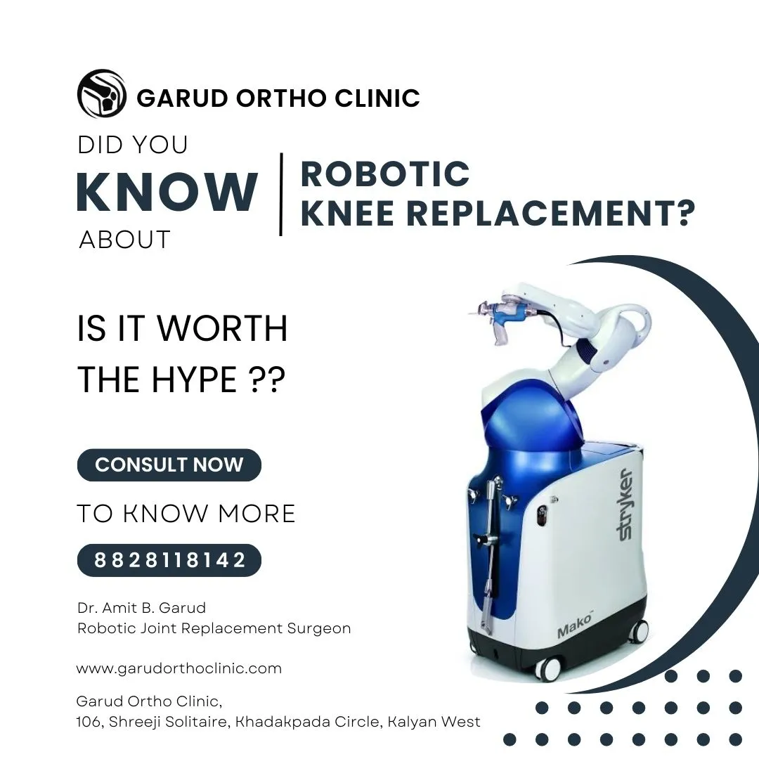 DID YOU KNOW ABOUT ROBOTIC KNEE REPLACEMENT ?
I...