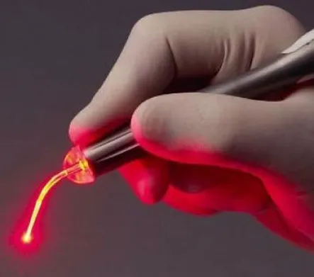 Laser Surgery for Hemorrhoids (Piles): A Revolutio...