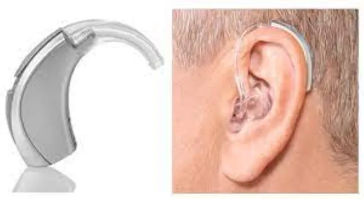 Hearing Aid Prices in Nagpur – Affordable and Tran...