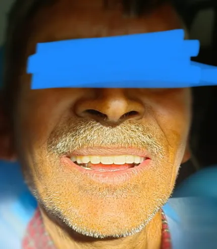 GO from no teeth to fixed teeth in just 72 hours!
...