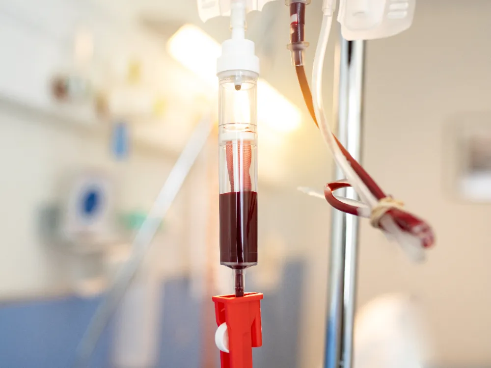 Dialysis Products in Pune: Quality Care for Kidney...