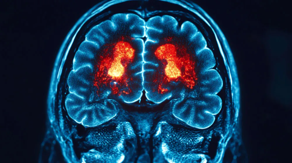 Head Injury and Brain Hemorrhage Treatment in Pune...