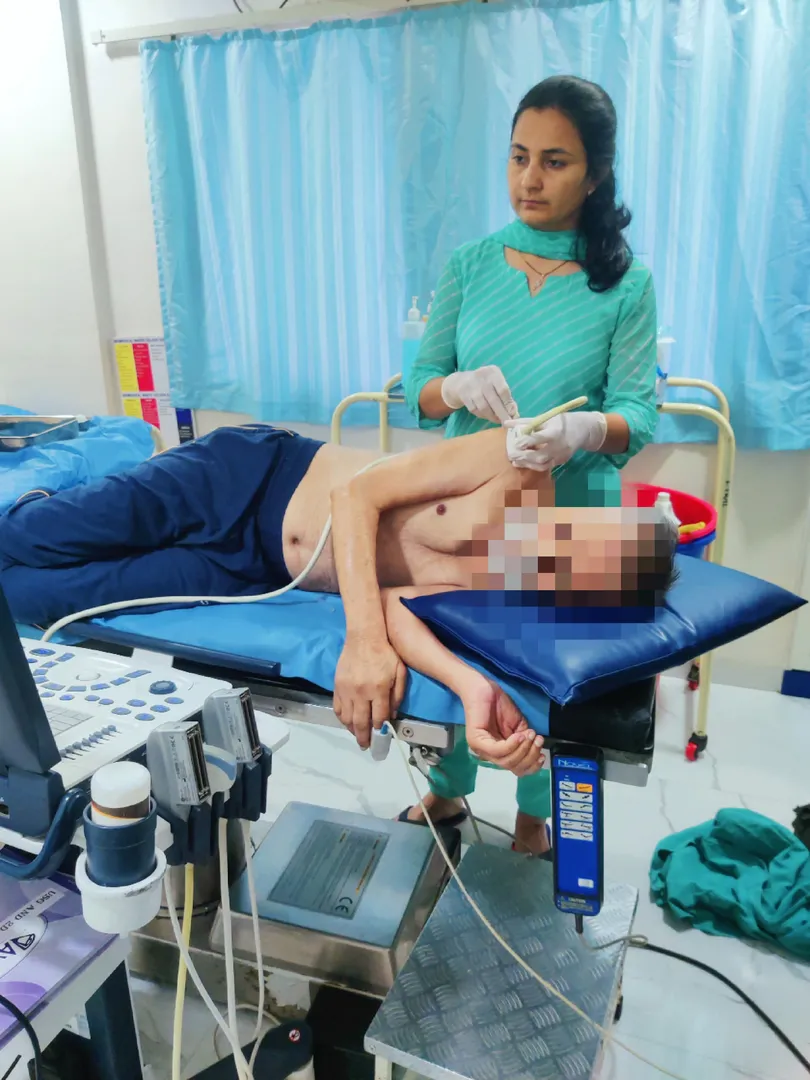The Role of Ultrasound-Guided Dry Needling in Canc...