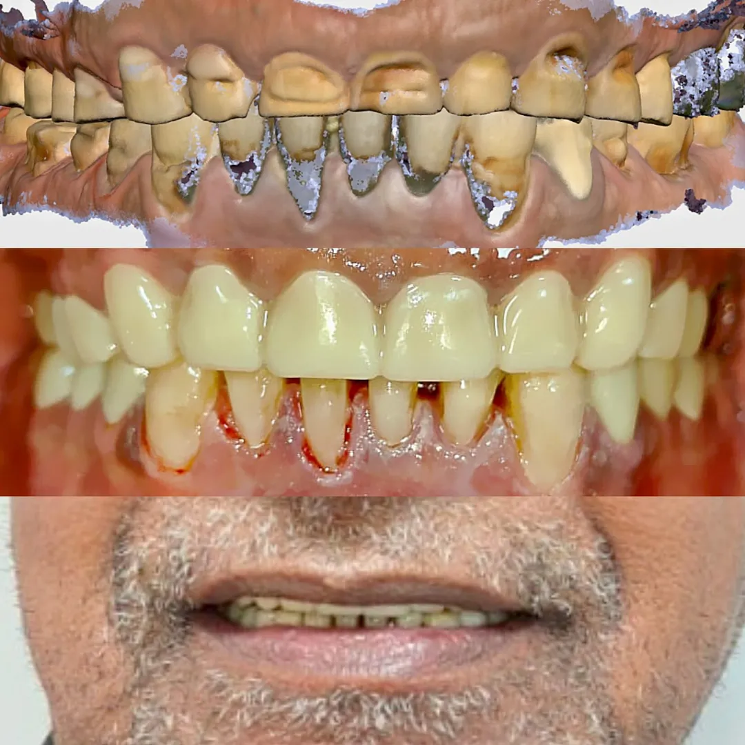 Full mouth rehabilitations are absolutely game cha...
