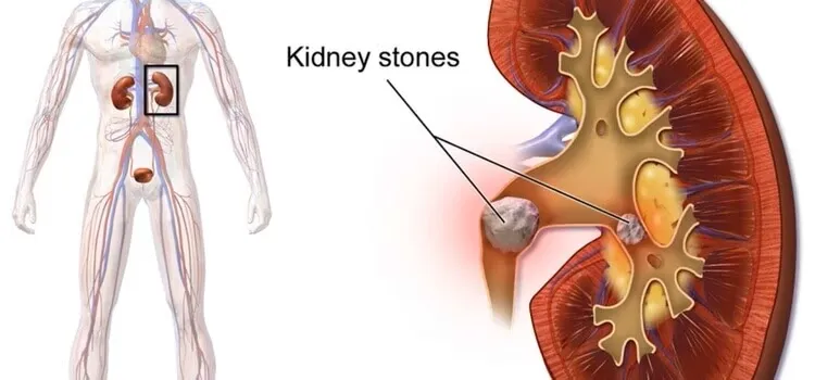 "Siddhi Vinayak Hospital in Maninagar, Ahmedabad, ...