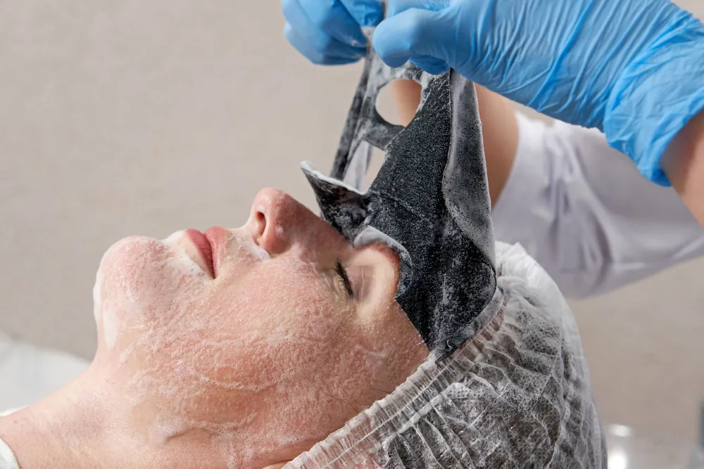 Best Chemical Peels in Pune for Clear and Youthful...