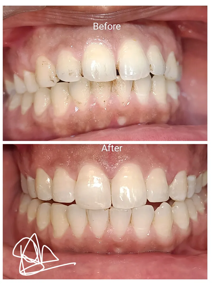 Case History
Patient Details
Name: xyz
Age and ...