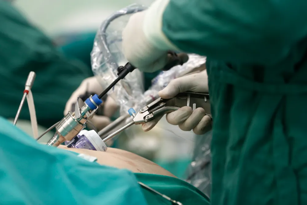 Gallstone Surgeon in Manpada, Thane West If you ne...
