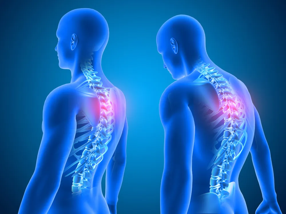 Deformity Correction in Pimpri-Chinchwad: Restorin...