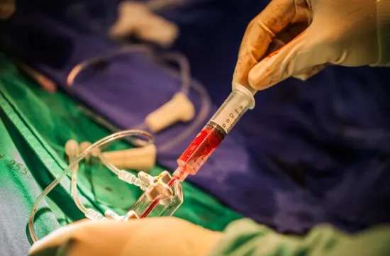 Dialysis Catheter Supplier in Pune Dialysis cathet...