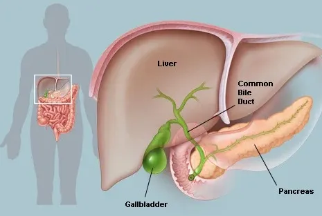 Looking for Gallstone Surgeon/Gallbladder Surgeon ...