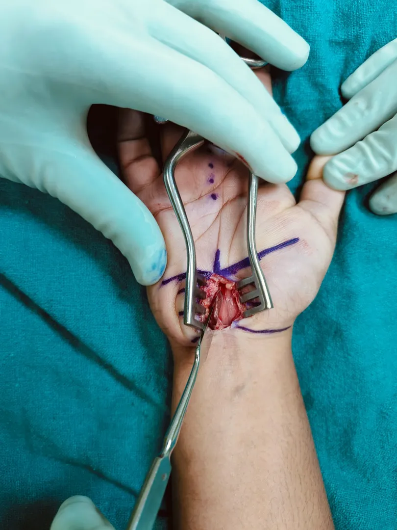 26 Years old doctor treated successfully,suffering...
