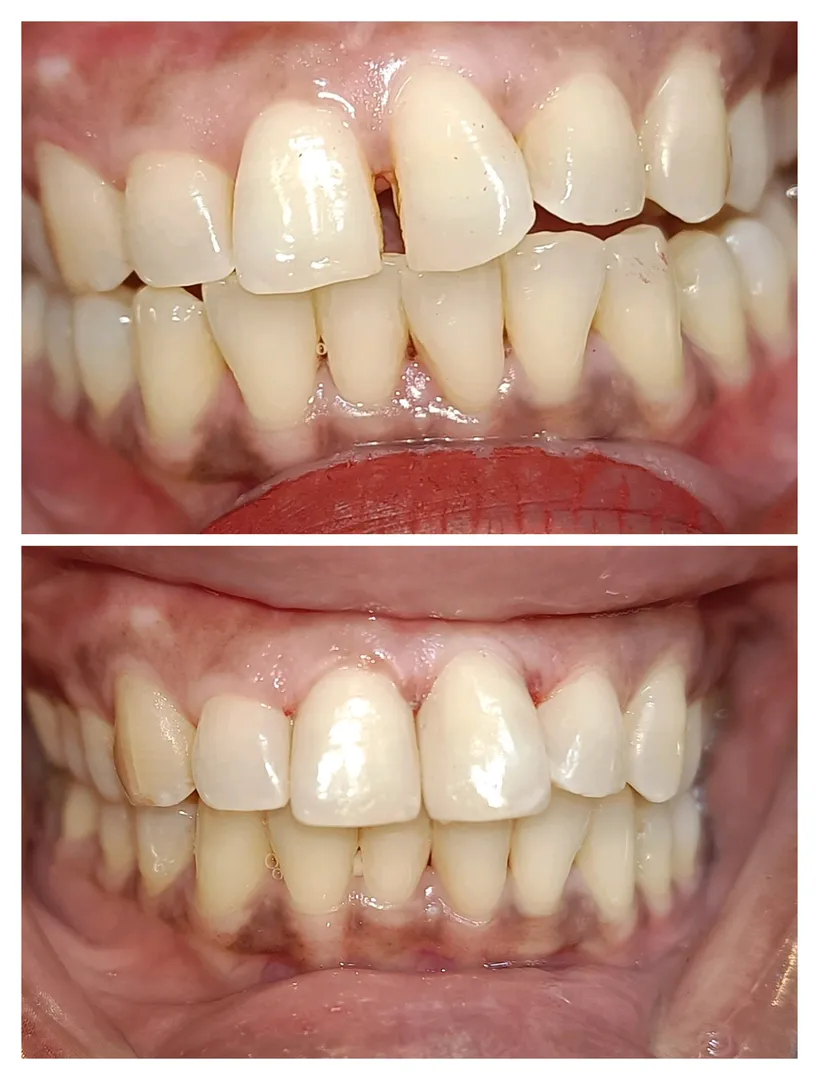 Say Goodbye to Gaps and Decay
Are you worried abo...