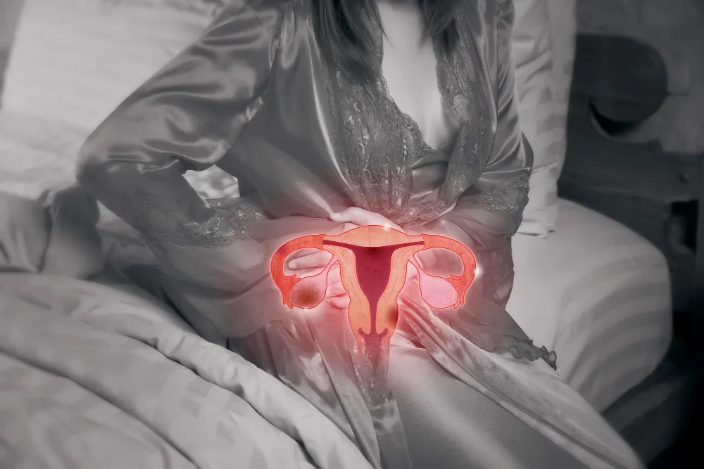 Endometriosis Treatment in Thane: Expert Care for ...