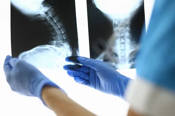 Spine Tumor Surgery in Pune - Advanced Care for Pa...