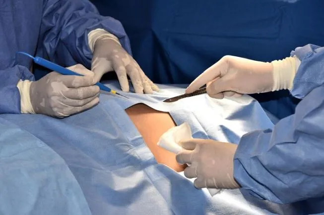 Abdominal Surgery in Thane: Safe Solutions for Com...