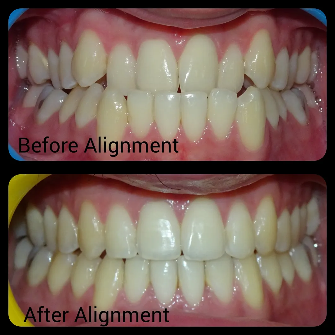 Well aligned teeth do not jury improve your SMILE ...