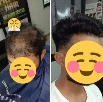 Best USA Technique Hair Weaving in Nagpur: Advance...