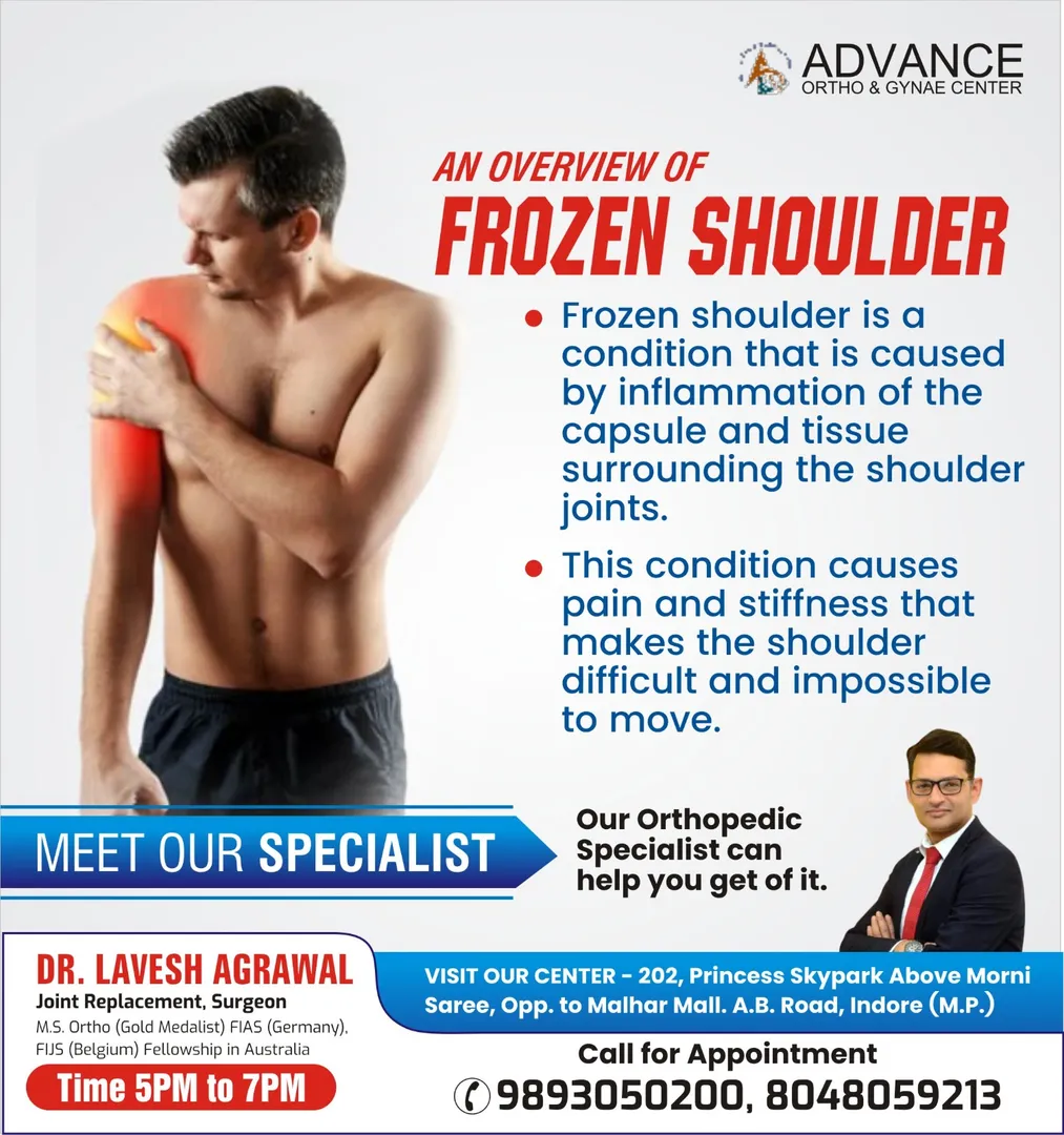 Best Orthopedic Doctor for Frozen Shoulder Treatme...
