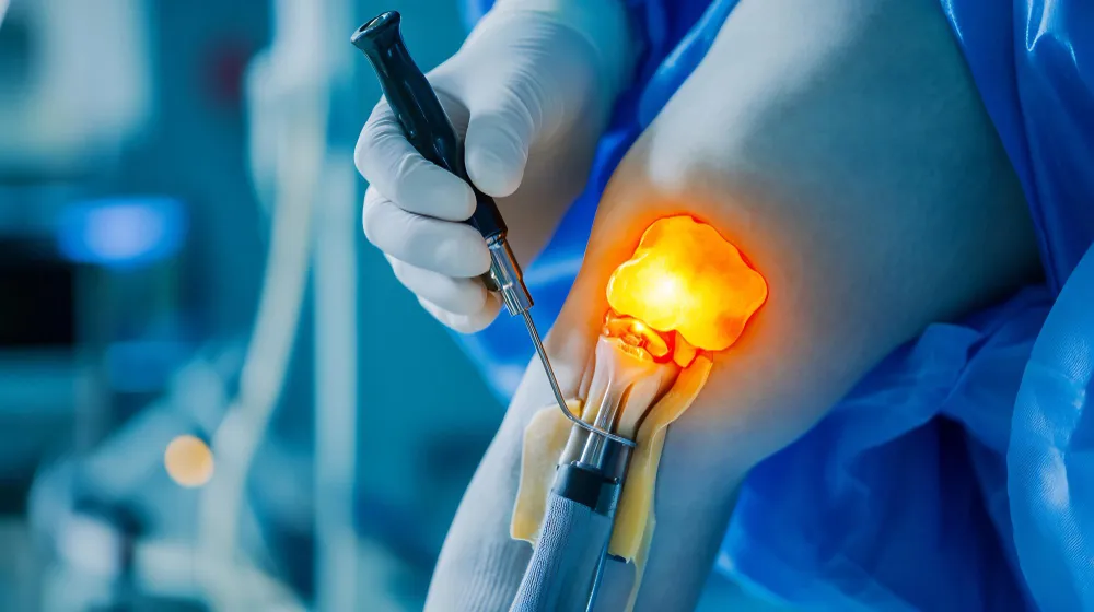 Arthroscopy Treatment in Pimpri-Chinchwad If you a...