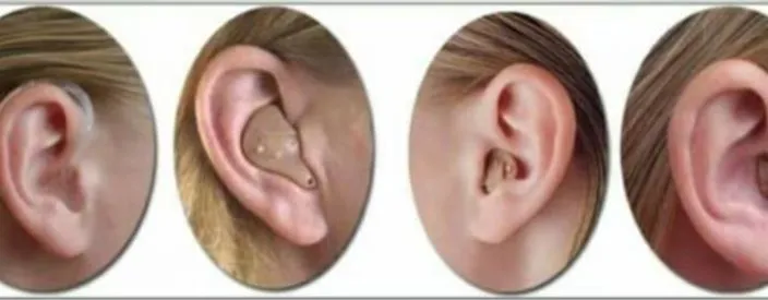 Kan Ki Machine in Nagpur: Affordable Hearing Solut...