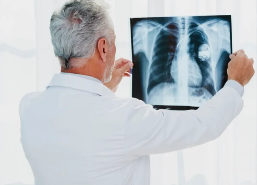 Best Chest Doctor in Trichy for Holistic Respirato...