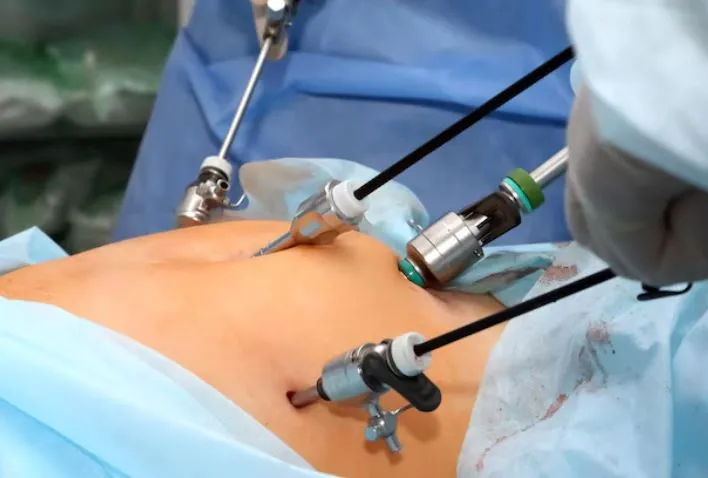 Laparoscopic Surgery in Thane: Advanced Minimally ...