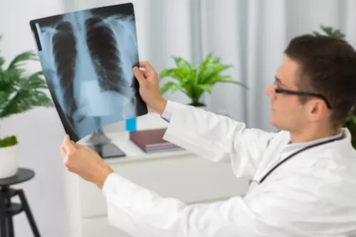Best Pulmonary Doctor in Trichy for Exceptional Ca...