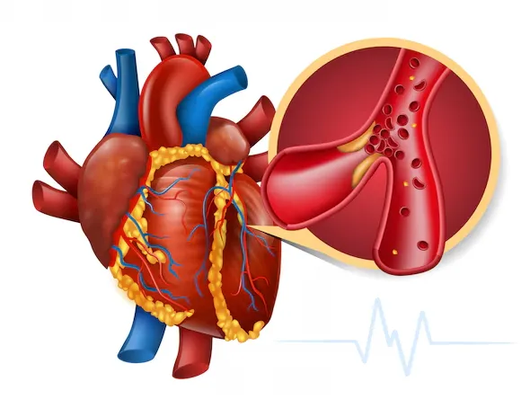 Advanced Care for Coronary Artery Disease in Chenn...