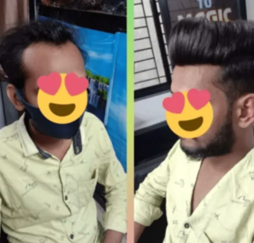 Best Gents Wig Center in Nagpur Looking for the be...
