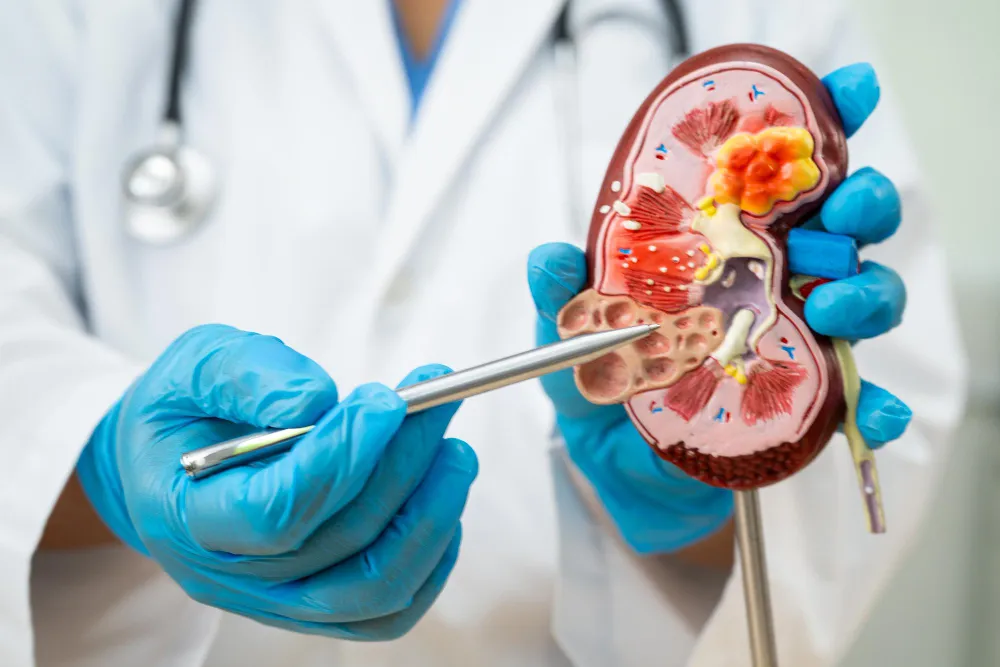 Best Kidney Stone Surgeon in Thane – Advanced Lase...