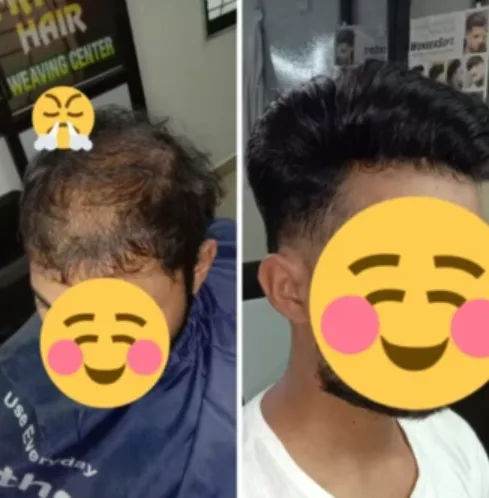 Best USA Technique Hair Weaving in Nagpur Our best...