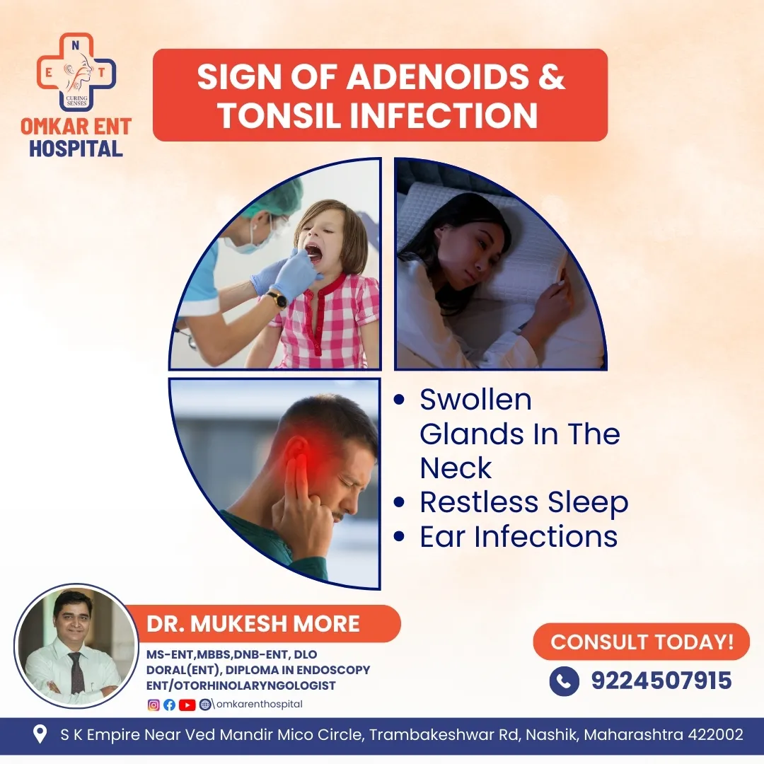Tonsillitis is swelling of the tonsils, adenoiditi...