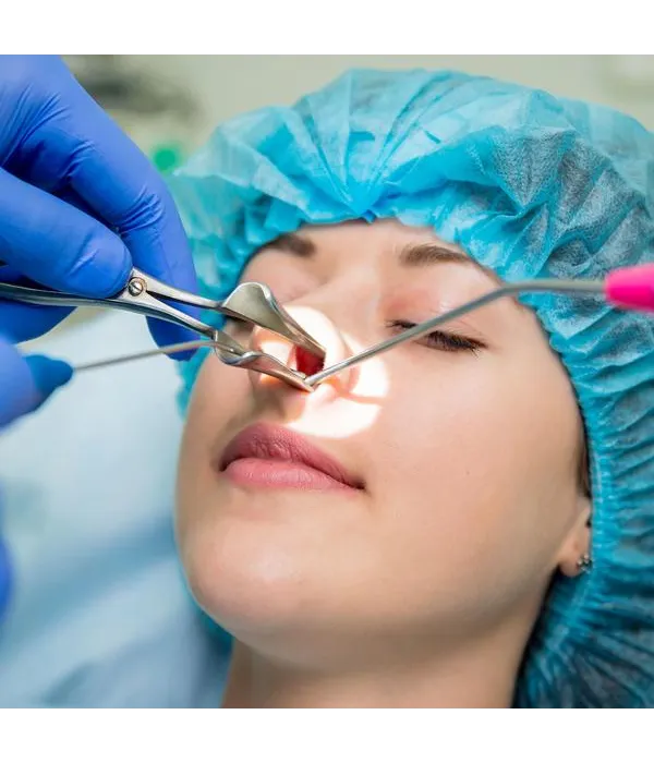 Rhinoplasty in Delhi
The rhinoplasty procedure ty...