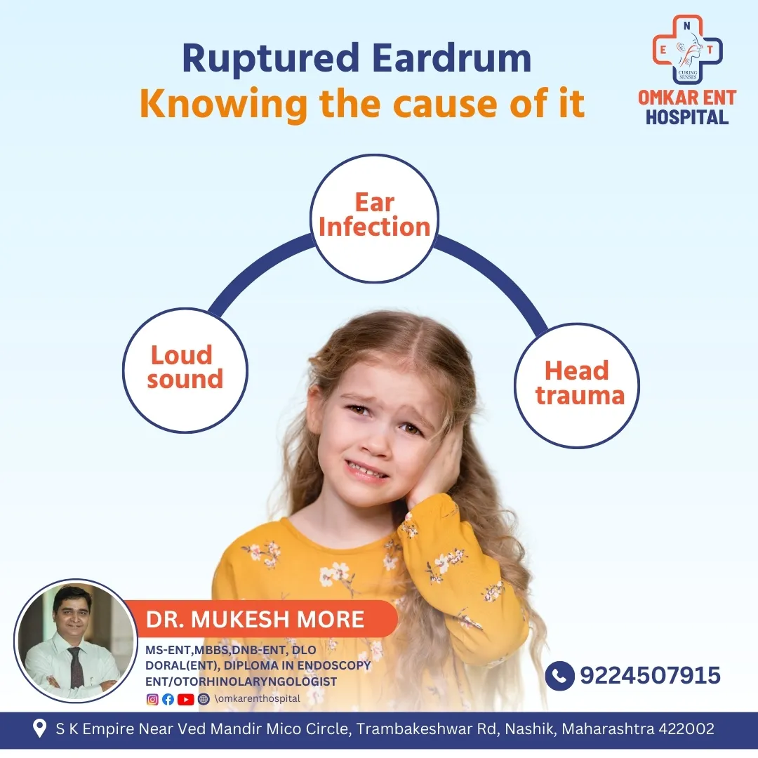 Ruptured Eardrum Treatment in Nashik
A Ruptured Ea...