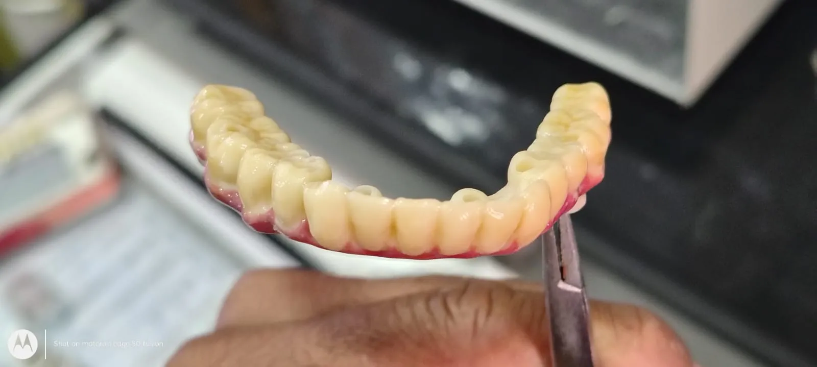 Can we chew normally after all teeth are replaced ...