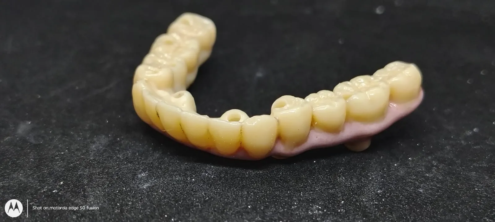Cost of dental implants..
Looking to replace all t...