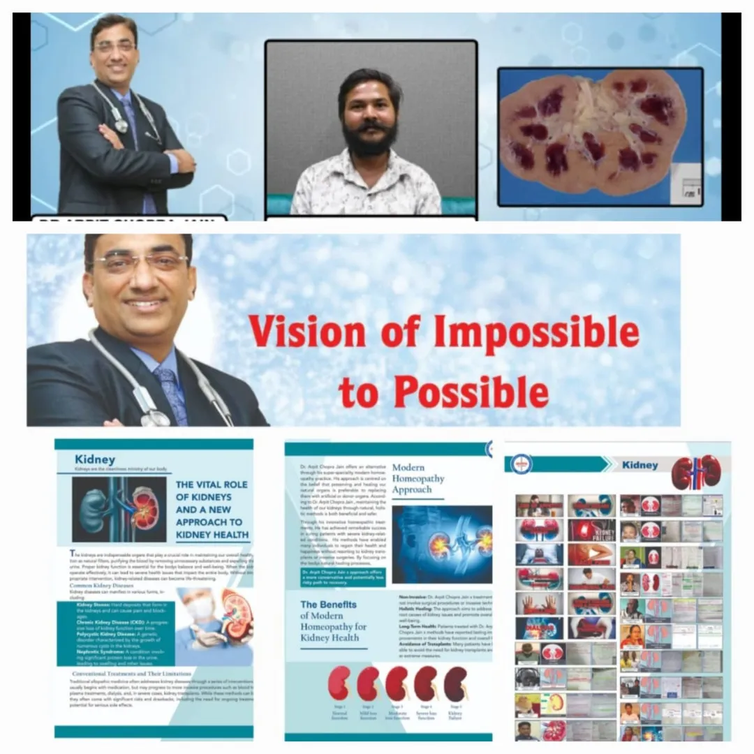 <div>Acute Kidney Diseses AKD Responded High Crea...