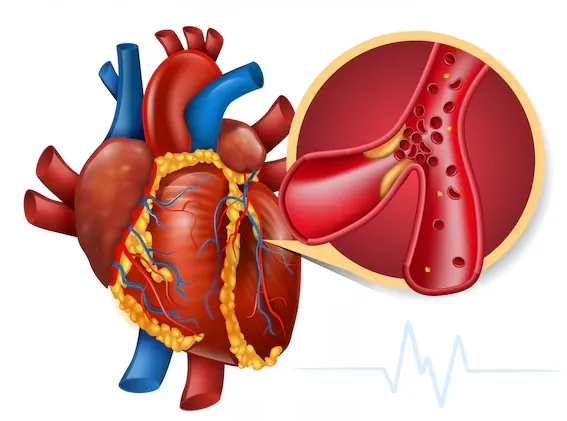 Heart Disease Treatment in Chennai – Comprehensive...