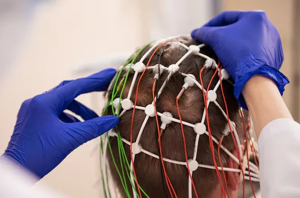 Brain Aneurysm Repair – Expert Surgical Interventi...
