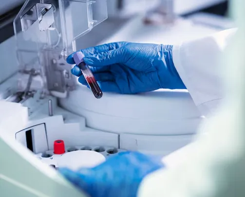 Advanced Lab Tests in Mumbai – Accurate Diagnostic...