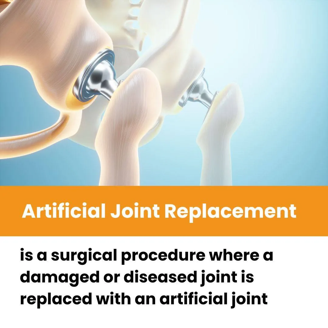 Artificial Joint Replacement is a highly effective...