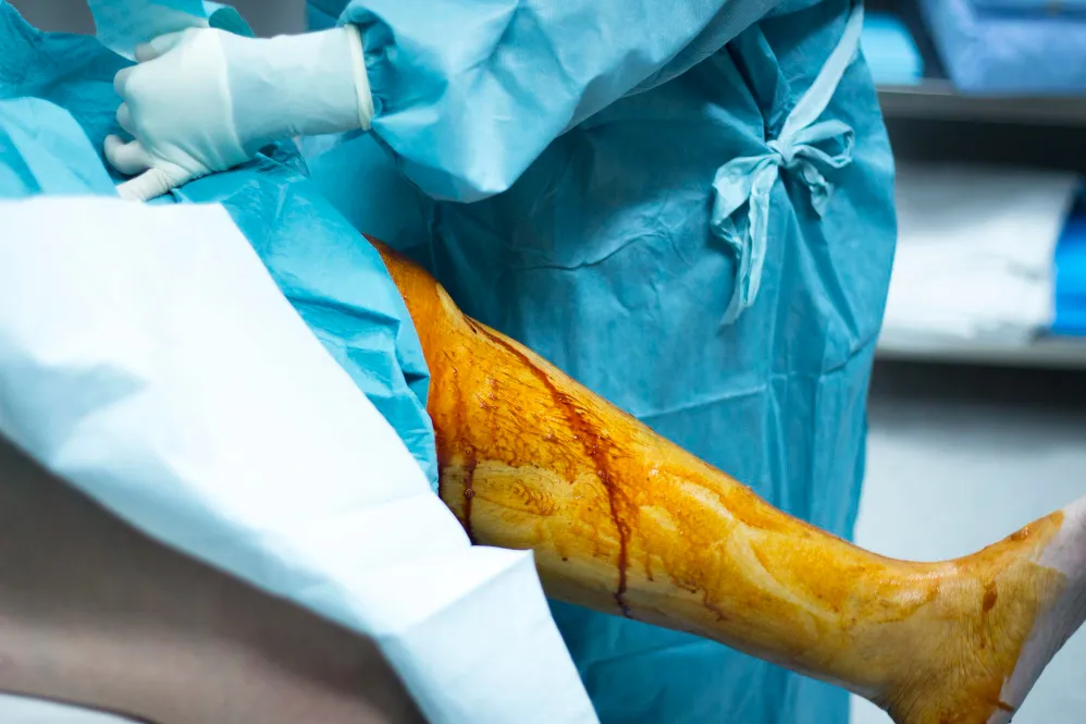 Fracture Surgery in Noida – Quick Healing with Exp...