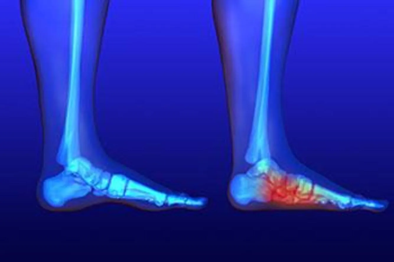 Deformity Correction in Pimpri-Chinchwad – Expert ...
