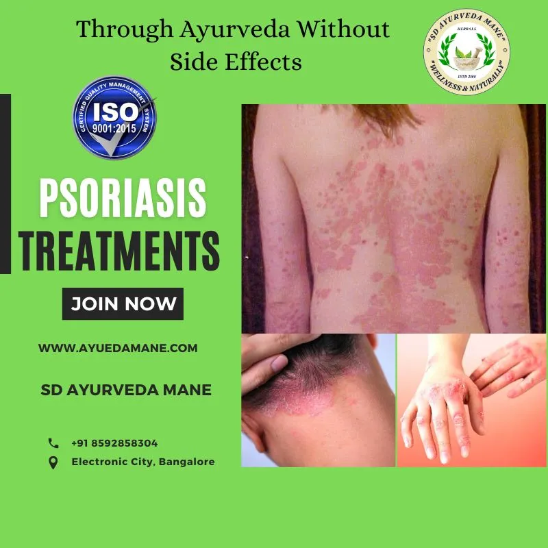 Advantages of Ayurvedic Skin Care Treatment at SD ...